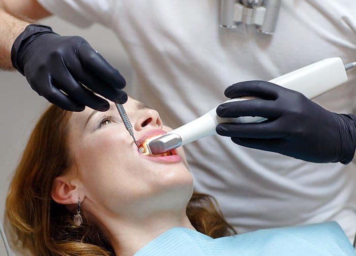 ¿Qué es una obturacion dental? Clínica B. Murri