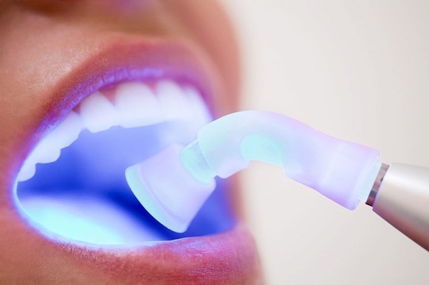 Cuidados para la hipoplasia dental